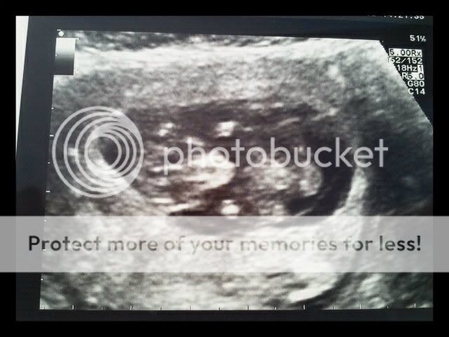 304857_437784052927048_2042264213_n